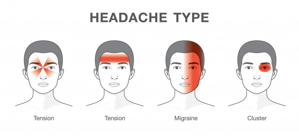 Headache Types